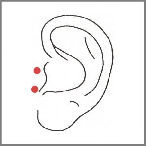 Wir raten Euch dringend davon ab, dieses Piercing in einem Schmuckgeschäft oder bei einem Juwelier machen zu lassen, denn dort wird es meist geschossen und bei diesem Vorgang kann das Gewebe oder der Knorpel einreissen. Dadurch kann es zu Knorpeldeformierungen und Wucherungen kommen!